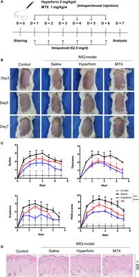 Hyperforin Ameliorates Imiquimod-Induced Psoriasis-Like Murine Skin Inflammation by Modulating IL-17A–Producing γδ T Cells